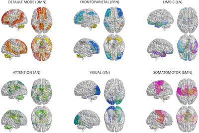Virtual brain simulations reveal network-specific parameters in neurodegenerative dementias